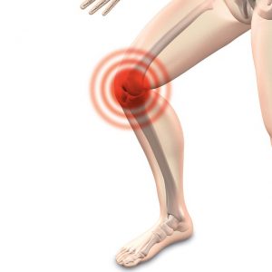 Patellabandage gegen Knie Schmerzen